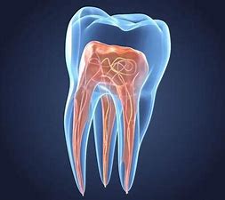 endodonzia - Dott.Riccardo Giorgi Studi Dentistici a La Spezia